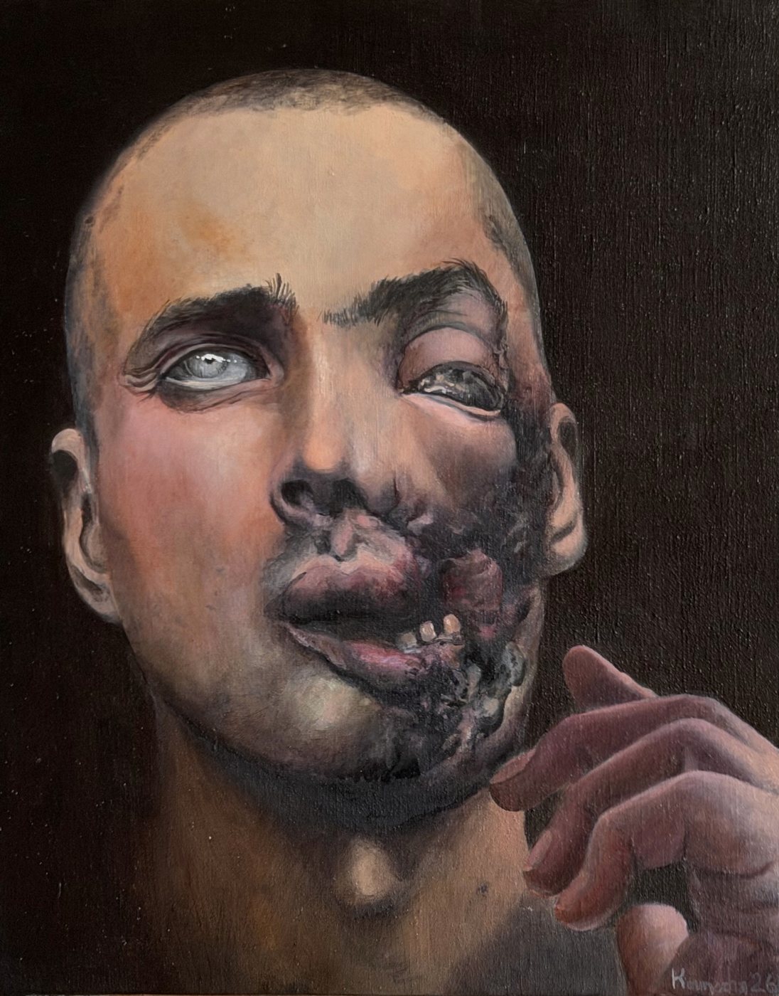 Visage à la bouche blessée, une main levée près de la joue.